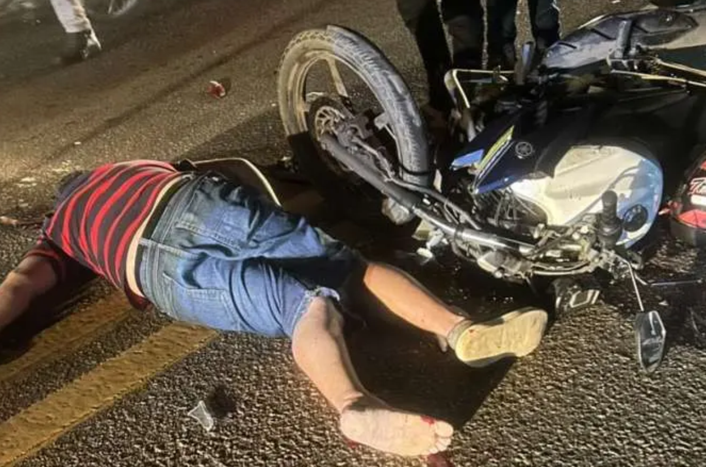 Colisão entre duas motos deixa dois motociclistas gravemente feridos em Arapiraca