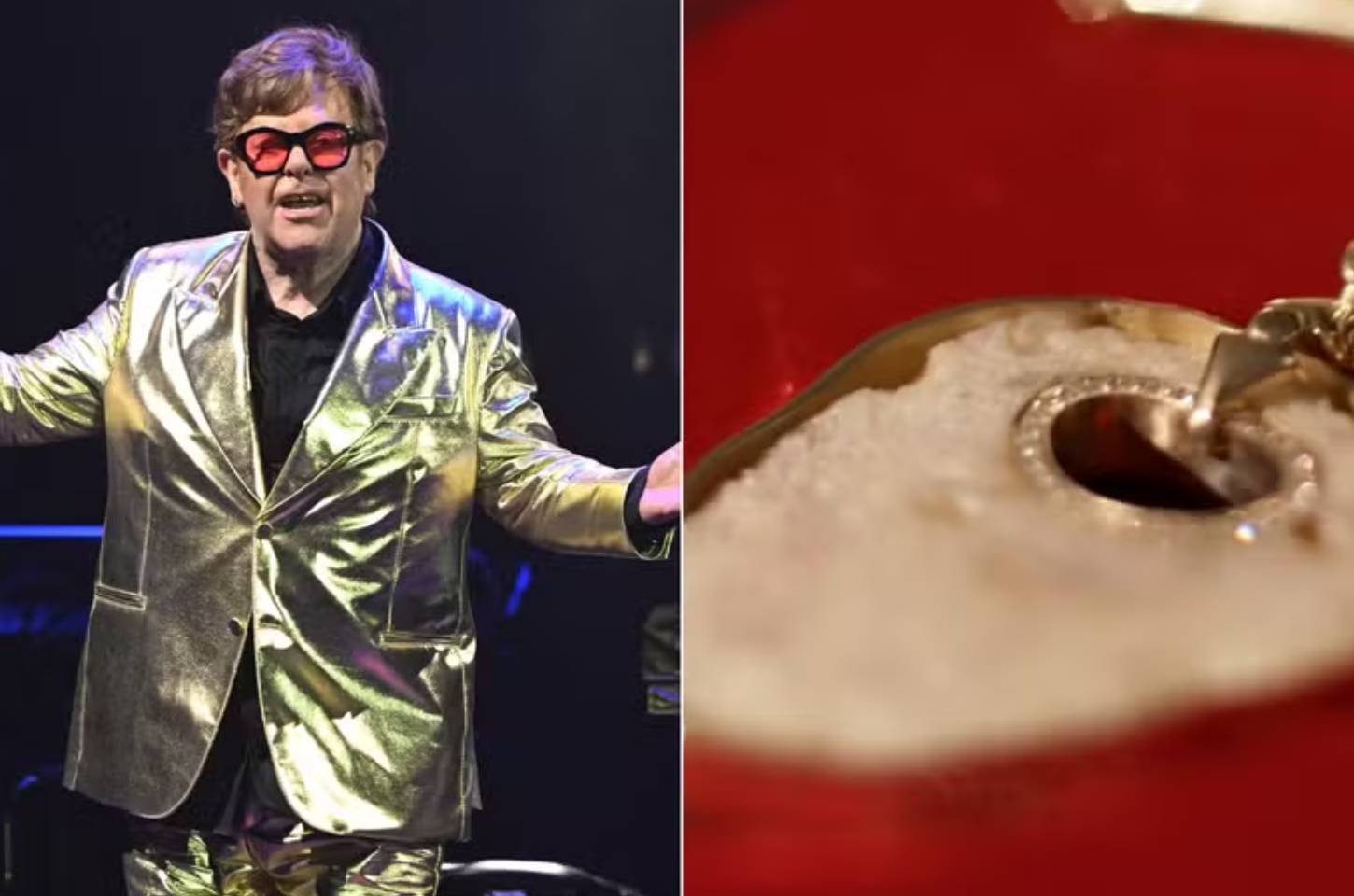 Elton John transforma partes do próprio corpo retiradas em cirurgias em joias de ouro
