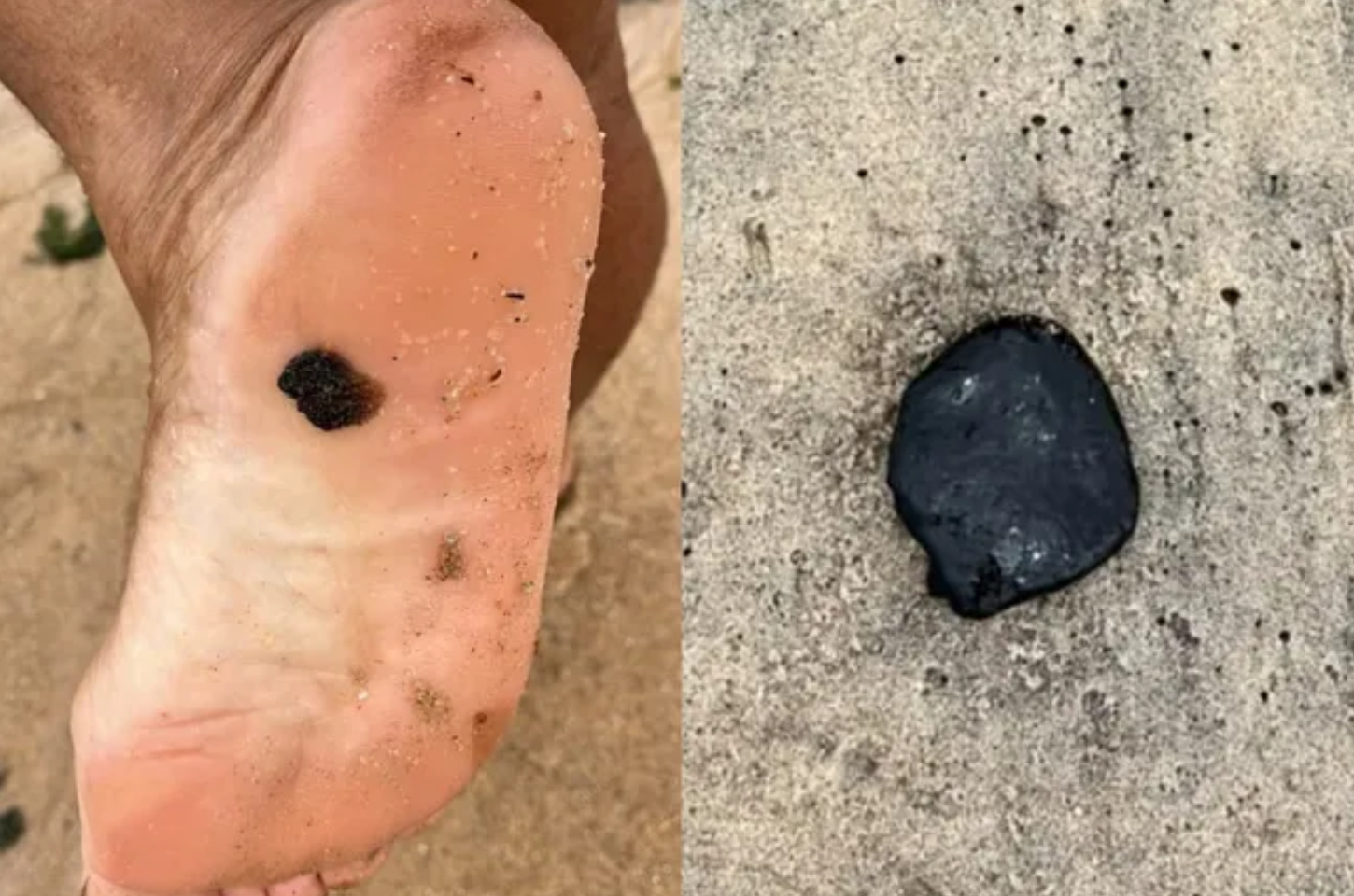 Manchas de óleo voltam a surgir no litoral de Alagoas e origem ainda é desconhecida