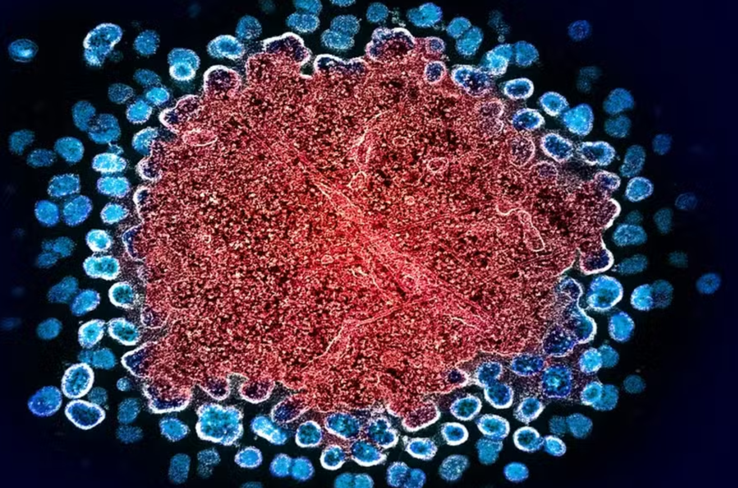 Por que a cura do HIV ainda é um desafio para a ciência?